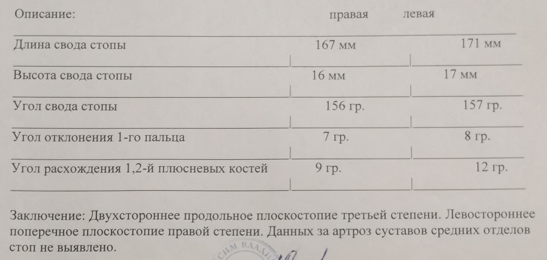 Плоскостопия 3 степени? - povestka.org